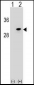 POLR2D Antibody (Center)